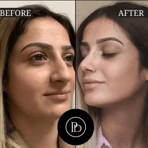 PRP Treatment in Dubai: The Science Behind the Beauty