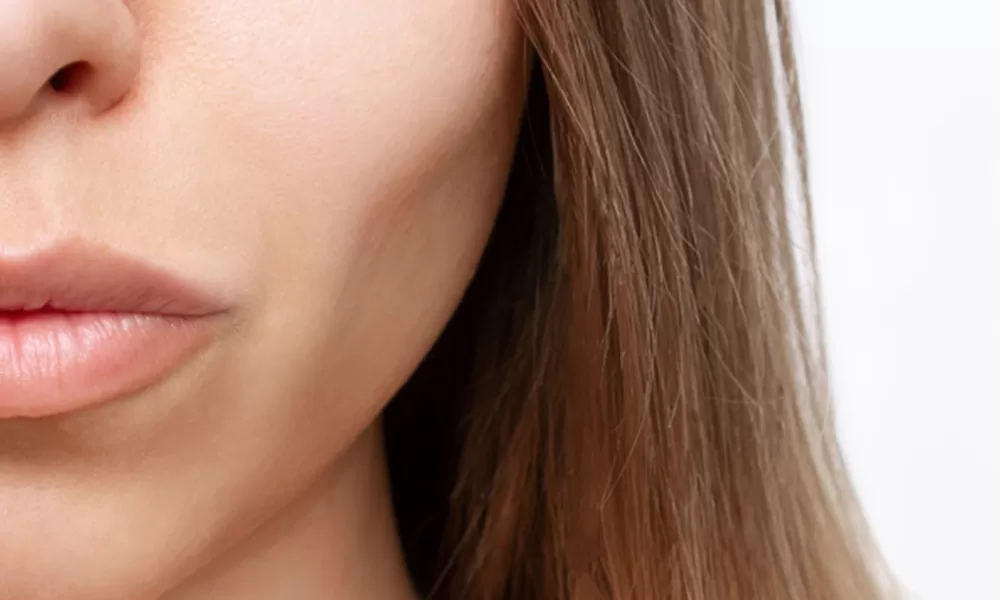 sculptra fillers