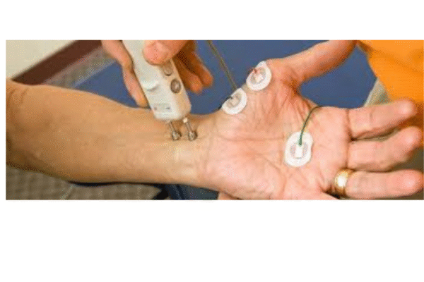 Comprehensive Guide to NCV Nerve Test in Bangalore: Purpose, Process & Benefits NCV Nerve Test in Bangalore