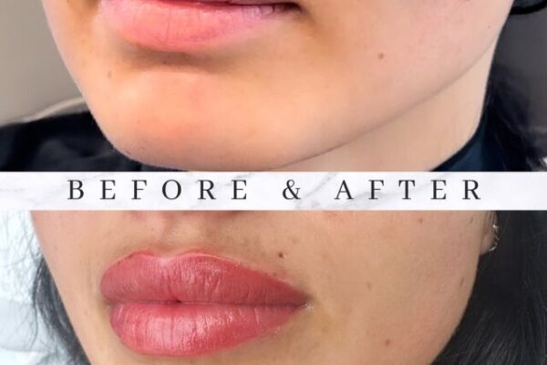 skin clinic Richmond